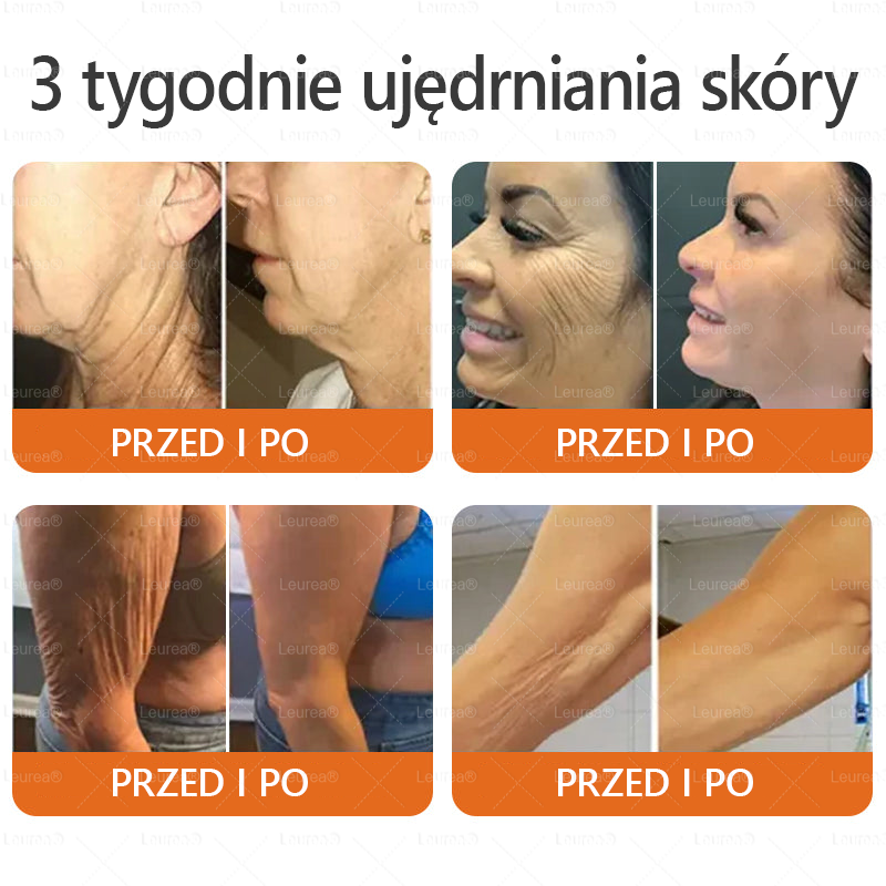 ✨Leurea® Krem Regenerujący z Jadem Pszczelim🔥 Naturalna regeneracja skóry, wygładzenie zmarszczek i promienna cera-50 ml🔥
