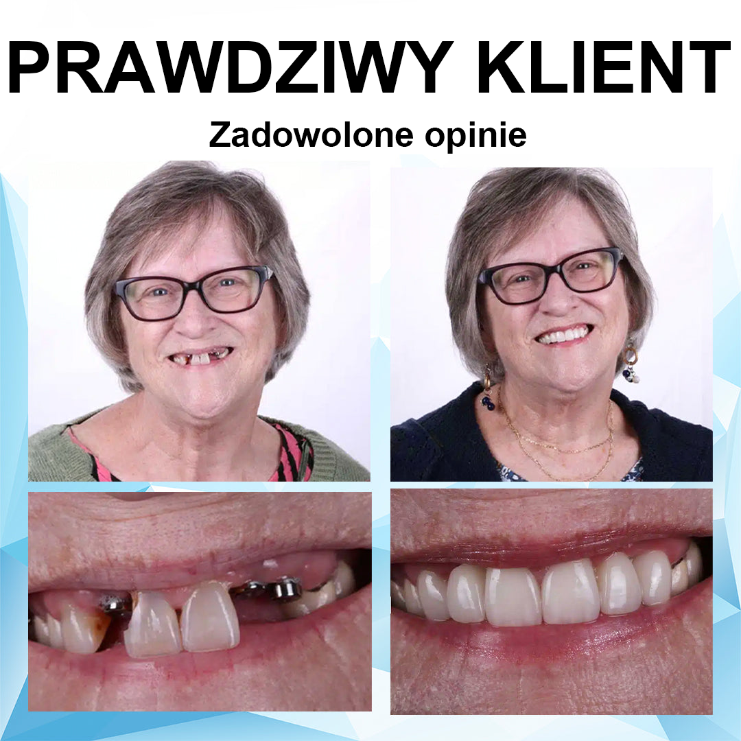 💎💥💎💥Gratulujemy, że stałeś się jednym z pierwszych 200 zamówień! Ciesz się dodatkową zniżką 50%! Działaj teraz i pokaż swój pewny uśmiech. Jeśli przegapisz tę okazję, nowa pojawi się dopiero w przyszłym roku!