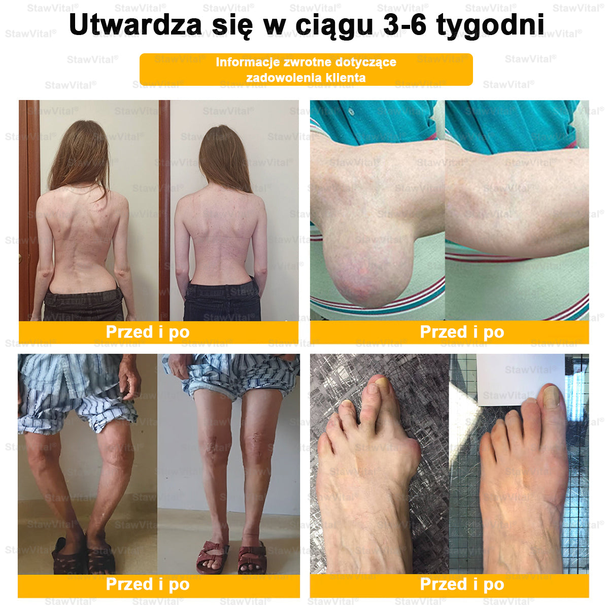 👨‍⚕️ 𝑺𝒕𝒂𝒘𝑽𝒊𝒕𝒂𝒍® 𝑲𝒓𝒆𝒎 𝒛 𝑱𝒂𝒅𝒆𝒎 𝑷𝒔𝒛𝒄𝒛𝒆𝒍𝒊𝒎 𝑳𝒆𝒄𝒛𝒏𝒊𝒄𝒛𝒚 𝒅𝒐 𝑹𝒆𝒈𝒆𝒏𝒆𝒓𝒂𝒄𝒋𝒊 𝑺𝒕𝒂𝒘ó𝒘 🏃‍♀️ (𝒆𝒌𝒔𝒕𝒓𝒂𝒌𝒕 𝒛 𝒑𝒔𝒛𝒄𝒛𝒐ł𝒚 𝒏𝒐𝒘𝒐𝒛𝒆𝒍𝒂𝒏𝒅𝒛𝒌𝒊𝒆𝒋 - 𝒘𝒚𝒔𝒑𝒆𝒄𝒋𝒂𝒍𝒊𝒛𝒐𝒘𝒂𝒏𝒚 𝒘 𝒍𝒆𝒄𝒛𝒆𝒏𝒊𝒖 𝒔𝒄𝒉𝒐𝒓𝒛𝒆ń 𝒐𝒓𝒕𝒐𝒑𝒆𝒅𝒚𝒄𝒛𝒏𝒚𝒄𝒉 𝒊 𝒃ó𝒍𝒖 𝒔𝒕𝒂𝒘ó𝒘)