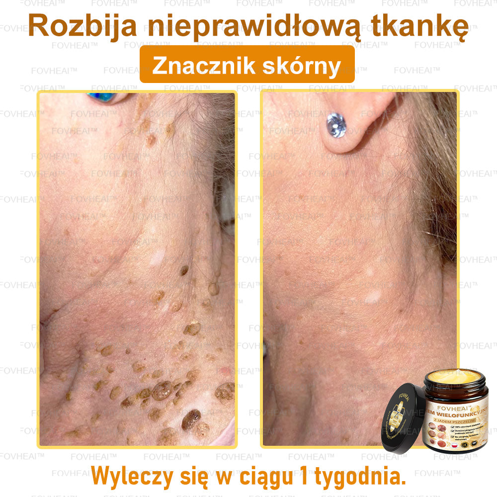 💎💎FOVHEAl™ Krem wielofunkcyjny z jadem pszczelim - Polecane przez dermatologów – Odpowiednie dla każdego wieku