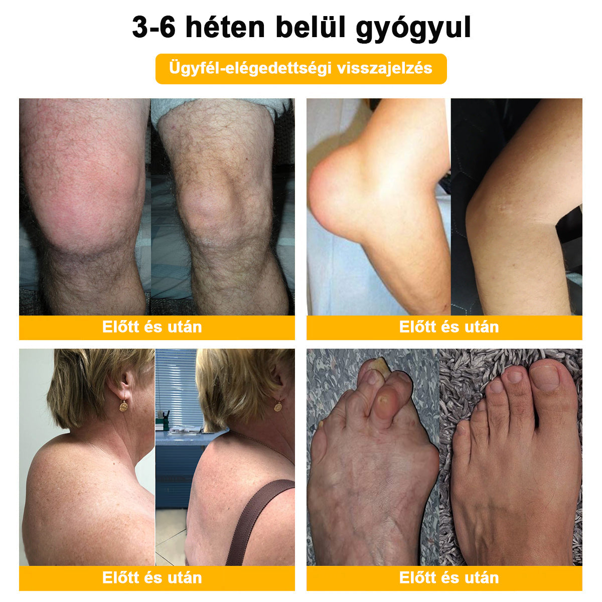 🐝🔥𝐈𝐳𝐮̈𝐥𝐞𝐭𝐢𝐕𝐢𝐭𝐚𝐥™ 𝐌𝐞́𝐡 𝐌𝐞́𝐫𝐞𝐠 𝐈𝐳𝐮̈𝐥𝐞𝐭𝐢 𝐑𝐞𝐠𝐞𝐧𝐞𝐫𝐚́𝐥𝐨 𝐊𝐞𝐳𝐞𝐥𝐨̋ 𝐊𝐫𝐞́𝐦 (𝐔́𝐣-𝐙𝐞́𝐥𝐚𝐧𝐝𝐢 𝐌𝐞́𝐡 𝐊𝐢𝐯𝐨𝐧𝐚𝐭 - 𝐒𝐳𝐚𝐤𝐨𝐬𝐨𝐝𝐢𝐤 𝐨𝐫𝐭𝐨𝐩𝐞́𝐝 𝐛𝐞𝐭𝐞𝐠𝐬𝐞́𝐠𝐞𝐤𝐫𝐞 𝐞́𝐬 𝐢𝐳𝐮̈𝐥𝐞𝐭𝐢 𝐟𝐚́𝐣𝐝𝐚𝐥𝐨𝐦𝐫𝐚)