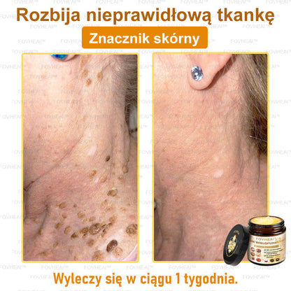 FOVHEAl™ Krem wielofunkcyjny z jadem pszczelim - Polecane przez dermatologów – Odpowiednie dla każdego wieku🔥🔥