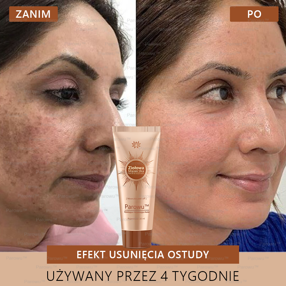 Parowu™ Wybielająca i Rozjaśniająca Maska - Naturalne składniki trwale usuwają plamy, piegi i przebarwienia🔥🔥🔥🔥