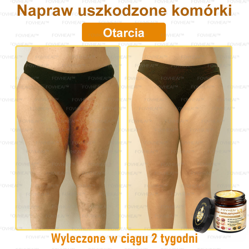 FOVHEAl™ Krem wielofunkcyjny z jadem pszczelim - Polecane przez dermatologów – Odpowiednie dla każdego wieku🔥🔥