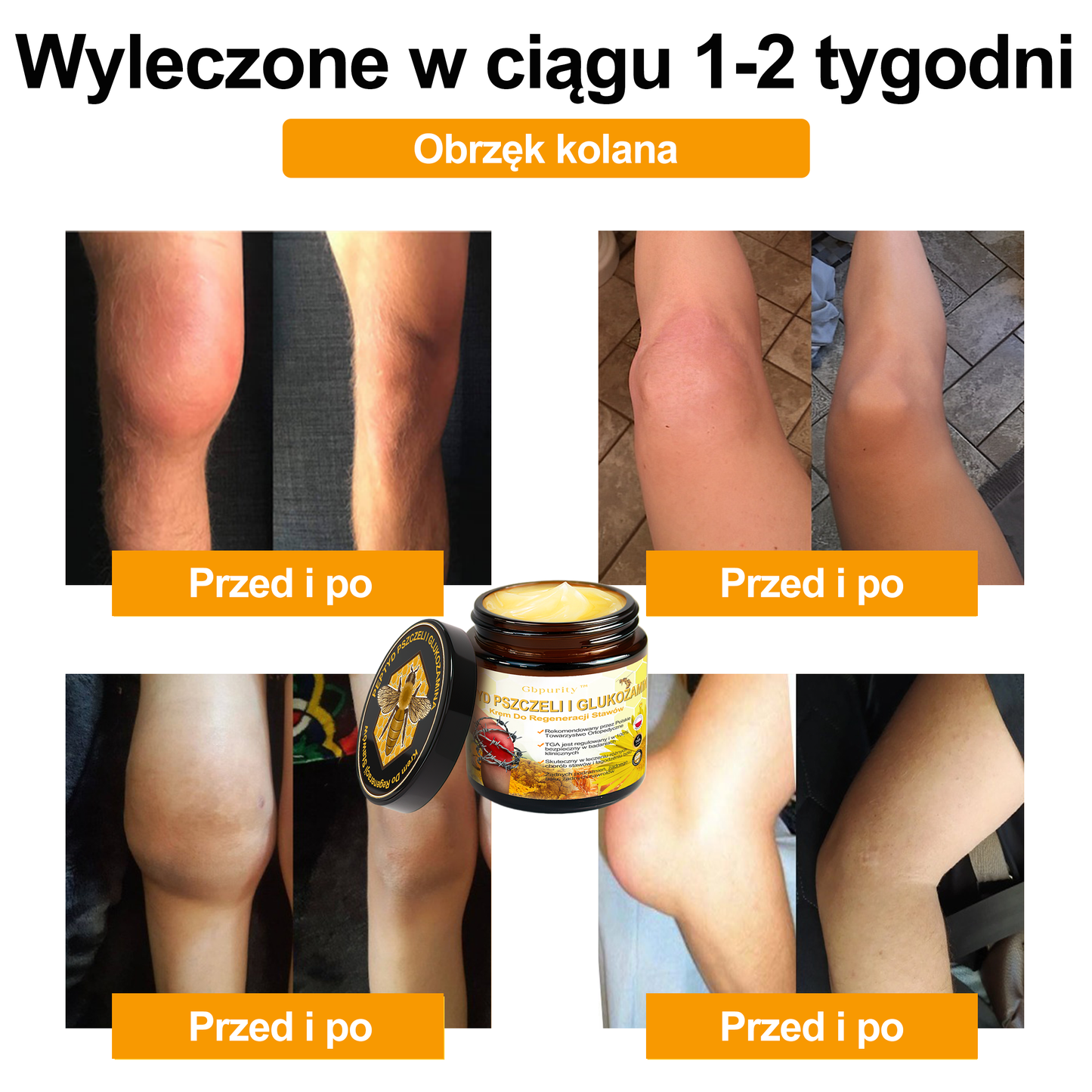 🛡️Gbpurity™ Krem Do Regeneracji Stawów | Dla osób w średnim i późnym wieku