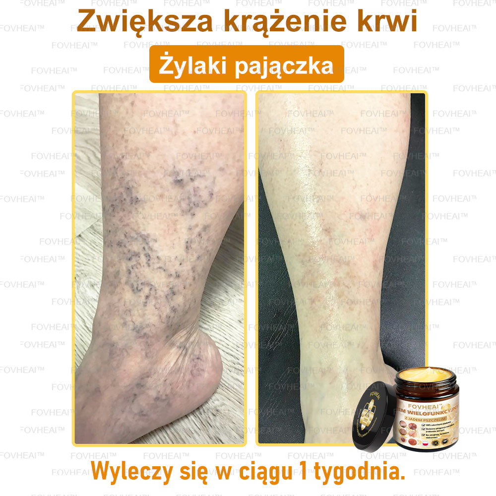 FOVHEAl™ Krem wielofunkcyjny z jadem pszczelim - Polecane przez dermatologów – Odpowiednie dla każdego wieku🔥🔥