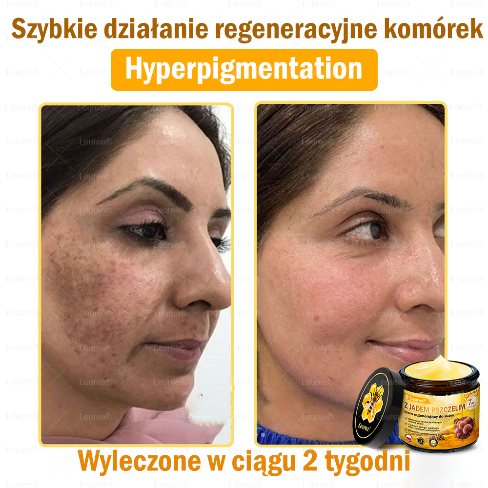 ✨Leurea® Krem Regenerujący z Jadem Pszczelim🔥 Naturalna regeneracja skóry, wygładzenie zmarszczek i promienna cera-50 ml🔥