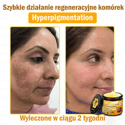 ✨Leurea® Krem Regenerujący z Jadem Pszczelim🔥 Naturalna regeneracja skóry, wygładzenie zmarszczek i promienna cera-50 ml🔥
