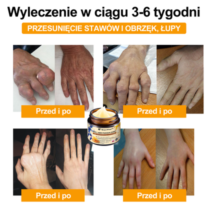 ✨🐝✨𝑺𝒕𝒂𝒘𝑽𝒊𝒕𝒂𝒍™ Krem z Jadem Pszczelim Leczniczy do Regeneracji Stawów - Zalecane przez Polskie Towarzystwo Ortopedyczne i Traumatologiczne🔥