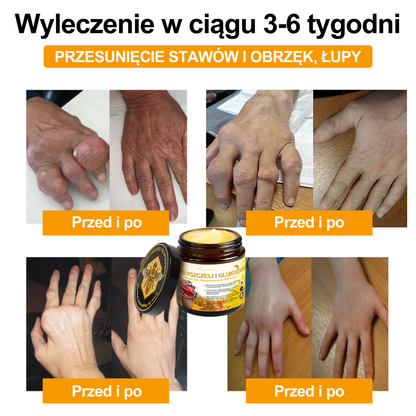 🛡️Gbpurity™ Krem Do Regeneracji Stawów | Dla osób w średnim i późnym wieku