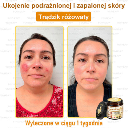 FOVHEAl™ Krem wielofunkcyjny z jadem pszczelim - Polecane przez dermatologów – Odpowiednie dla każdego wieku🔥🔥