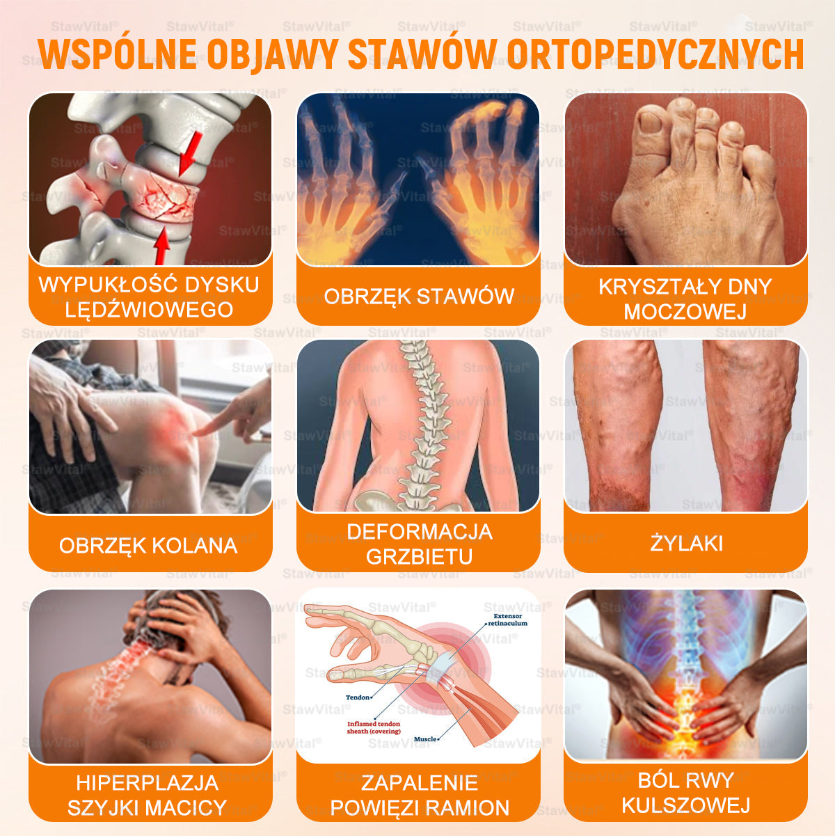 👨‍⚕️ 𝑺𝒕𝒂𝒘𝑽𝒊𝒕𝒂𝒍® 𝑲𝒓𝒆𝒎 𝒛 𝑱𝒂𝒅𝒆𝒎 𝑷𝒔𝒛𝒄𝒛𝒆𝒍𝒊𝒎 𝑳𝒆𝒄𝒛𝒏𝒊𝒄𝒛𝒚 𝒅𝒐 𝑹𝒆𝒈𝒆𝒏𝒆𝒓𝒂𝒄𝒋𝒊 𝑺𝒕𝒂𝒘ó𝒘 🏃‍♀️ (𝒆𝒌𝒔𝒕𝒓𝒂𝒌𝒕 𝒛 𝒑𝒔𝒛𝒄𝒛𝒐ł𝒚 𝒏𝒐𝒘𝒐𝒛𝒆𝒍𝒂𝒏𝒅𝒛𝒌𝒊𝒆𝒋 - 𝒘𝒚𝒔𝒑𝒆𝒄𝒋𝒂𝒍𝒊𝒛𝒐𝒘𝒂𝒏𝒚 𝒘 𝒍𝒆𝒄𝒛𝒆𝒏𝒊𝒖 𝒔𝒄𝒉𝒐𝒓𝒛𝒆ń 𝒐𝒓𝒕𝒐𝒑𝒆𝒅𝒚𝒄𝒛𝒏𝒚𝒄𝒉 𝒊 𝒃ó𝒍𝒖 𝒔𝒕𝒂𝒘ó𝒘)