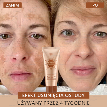 Parowu™ Wybielająca i Rozjaśniająca Maska - Naturalne składniki trwale usuwają plamy, piegi i przebarwienia🔥🔥🔥🔥