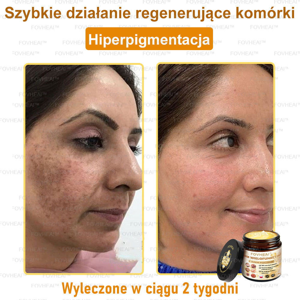 FOVHEAl™ Krem wielofunkcyjny z jadem pszczelim - Polecane przez dermatologów – Odpowiednie dla każdego wieku🔥🔥