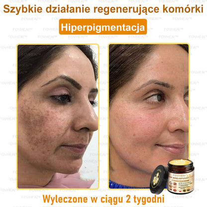 FOVHEAl™ Krem wielofunkcyjny z jadem pszczelim - Polecane przez dermatologów – Odpowiednie dla każdego wieku🔥🔥