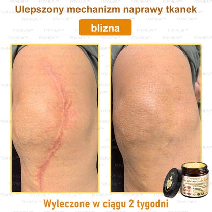 FOVHEAl™ Krem wielofunkcyjny z jadem pszczelim - Polecane przez dermatologów – Odpowiednie dla każdego wieku🔥🔥